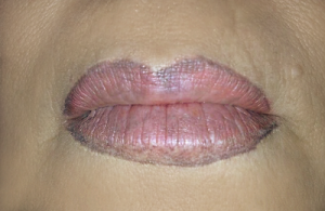 csm_lippenkorrektur1_120dpi_b806acaaa3