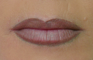 csm_lippenkorrektur2_120dpi_38a03a24fd