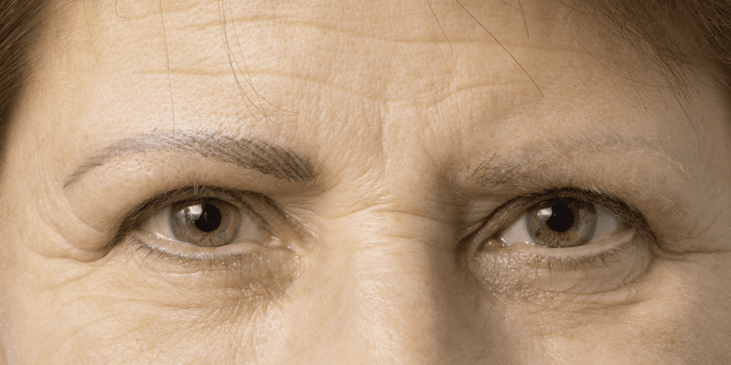 Auge_020_M