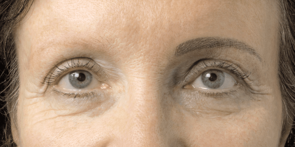 Auge_020a_M