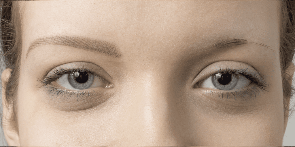 Auge_020c_M