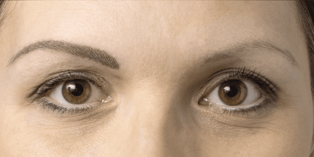 Auge_020d_M